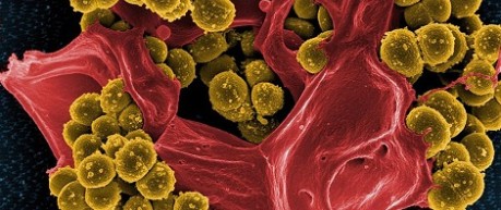 image of bacteria - credit Roslin Institute
