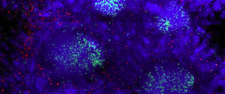 Photo of M cells - specialised cells to detect a persons risk of contracting prion diseases after consuming infected food.