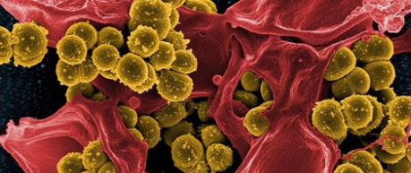 photo of bacteria - image credit UoE, The Roslin Institute