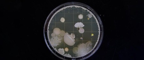 image of bacteria - credit University of Edinburgh